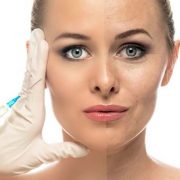 Fat Injection Clinic in Karaj