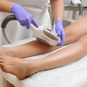 Laser hair loss in Karaj